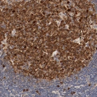 Immunohistochemical staining of human lymph node shows strong cytoplasmic and nucelar membranous positivity in germinal center cells.