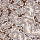 Immunohistochemical staining of human duodenum shows strong cytoplasmic positivity in lymphoid cells.