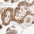 Immunohistochemical staining of human placenta shows strong cytoplasmic and nuclear positivity in trophoblastic cells.