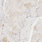 Anti-UBE2J1 Antibody