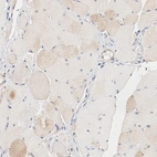 Immunohistochemical staining of human skeletal muscle shows weak cytoplasmic positivity in myocytes as expected.