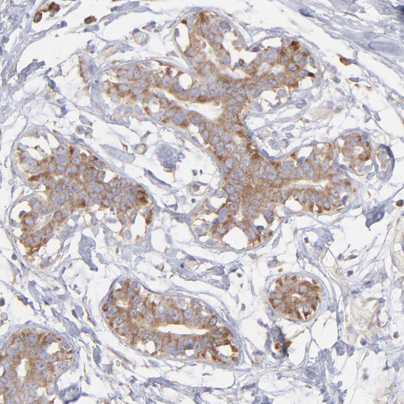 Anti-RPLP0 Antibody