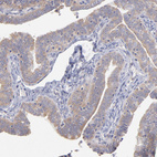 Immunohistochemical staining of human fallopian tube shows weak cytoplasmic positivity in glandular cells.