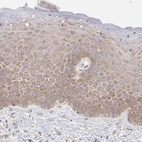 Immunohistochemical staining of human skin shows weak to moderate cytoplasmic positivity in squamous epithelial cells.
