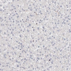 Immunohistochemical staining of human liver shows no positivity in hepatocytes as expected.