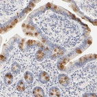 Immunohistochemical staining of human small intestine shows strong positivity in mucus in goblet cells.