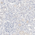 Immunohistochemical staining of human kidney shows low positivity in cells in tubules as expected.
