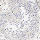 Immunohistochemical staining of human testis shows low positivity in cells in seminiferous ducts as expected.