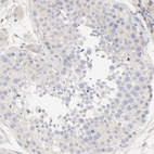 Anti-FCGBP Antibody