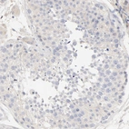 Immunohistochemical staining of human testis shows low positivity in cells in seminiferous ducts as expected.