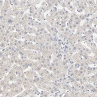 Immunohistochemical staining of human liver shows low positivity in hepatocytes as expected.
