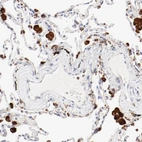 Immunohistochemical staining of human lung shows high expression.