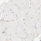 Immunohistochemical staining of human skeletal muscle shows low expression as expected.