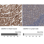 Anti-UQCRC1 Antibody