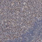 Immunohistochemical staining of human lymph node shows low expression as expected.