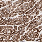 Anti-UQCRC1 Antibody