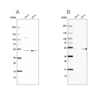 Western blot analysis using Anti-UQCRC1 antibody HPA003525 (A) shows similar pattern to independent antibody HPA002815 (B).