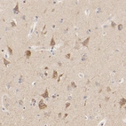 Immunohistochemical staining of human cerebral cortex shows moderate cytoplasmic positivity in neurons.