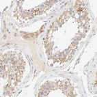 Immunohistochemical staining of human testis shows weak to moderate cytoplasmic positivity in cells in seminiferous ducts.