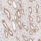 Immunohistochemical staining of human kidney shows moderate cytoplasmic positivity in cells in tubules.
