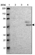 Lane 1: Marker [kDa] 229, 112, 84, 48, 32, 27, 17_br/_Lane 2: Human cell line RT-4_br/_Lane 3: Human cell line U-251MG sp_br/_Lane 4: Human plasma (IgG/HSA depleted)