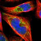 Immunofluorescent staining of human cell line A-431 shows localization to mitochondria.