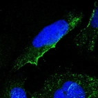 Immunofluorescent staining of human cell line U-2 OS shows localization to plasma membrane & vesicles.