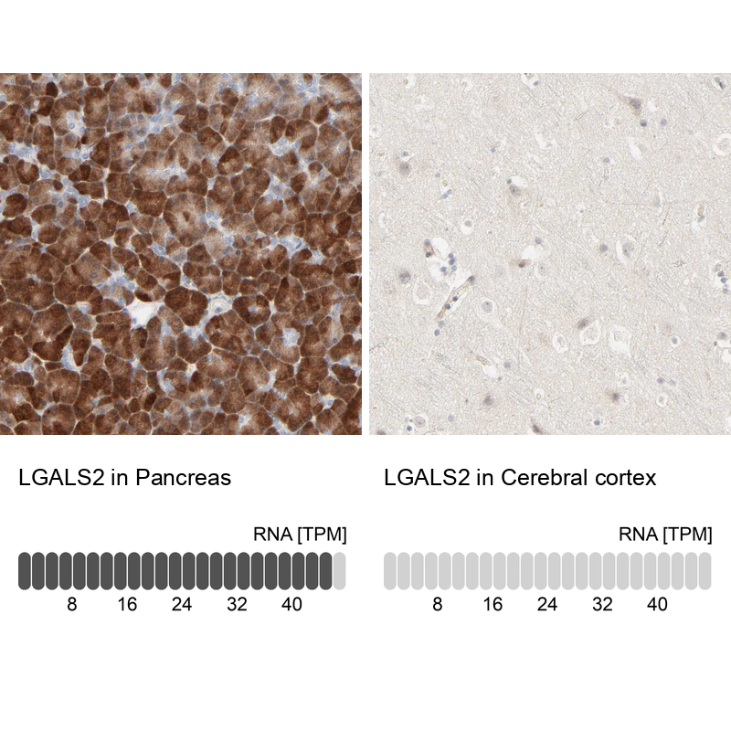 Anti-LGALS2 Antibody