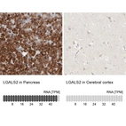 Anti-LGALS2 Antibody