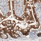Immunohistochemical staining of human small intestine shows strong cytoplasmic positivity in glandular cells.