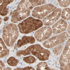 Immunohistochemical staining of human kidney shows moderate to strong cytoplasmic positivity in cells in tubules.