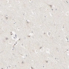 Immunohistochemical staining of human cerebral cortex shows no positivity in neurons.