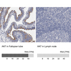 Anti-AK7 Antibody