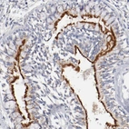 Immunohistochemical staining of human bronchus shows strong positivity in cilia.