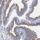 Immunohistochemical staining of human fallopian tube shows strong positivity in cilia in glandular cells.