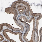 Immunohistochemical staining of human gallbladder shows high expression.