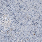 Immunohistochemical staining of human pancreas shows low expression as expected.