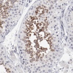 Anti-FSCB Antibody