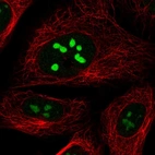 Immunofluorescent staining of human cell line U-2 OS shows localization to nucleoli.
