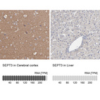 Anti-SEPT3 Antibody