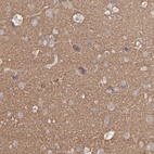 Immunohistochemical staining of human cerebral cortex shows high expression.