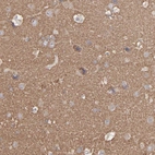 Immunohistochemical staining of human cerebral cortex shows high expression.