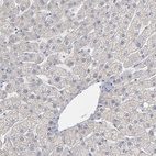 Immunohistochemical staining of human liver shows low expression as expected.