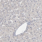 Immunohistochemical staining of human liver shows low expression as expected.