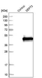 Western blot analysis in control (vector only transfected HEK293T lysate) and LY403438 over-expression lysate (Co-expressed with a C-terminal myc-DDK tag (~3.1 kDa) in mammalian HEK293T cells, LY403438).
