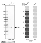 Western blot analysis in human cell lines Caco-2 and PC-3 using Anti-STXBP6 antibody. Corresponding STXBP6 RNA-seq data are presented for the same cell lines. Loading control: Anti-GAPDH.