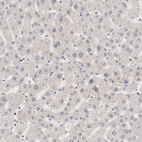 Immunohistochemical staining of human liver shows no nuclear positivity in hepatocytes as expected.