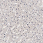 Immunohistochemical staining of human liver shows no nuclear positivity in hepatocytes as expected.