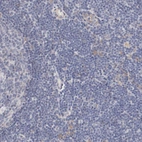Immunohistochemical staining of human lymph node shows no nuclear positivity in non-germinal center cells as expected.
