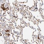 Immunohistochemical staining of human lung shows strong extracellular space positivity in macrophages.